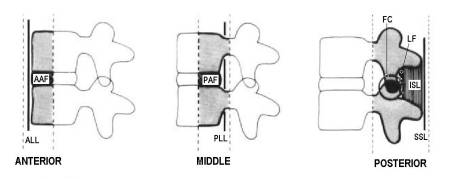 denis-three-column-theory.jpg