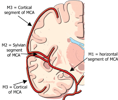 m2_segment_of_the_middle_cerebral_artery.jpg
