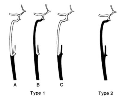 riles_classification.jpg
